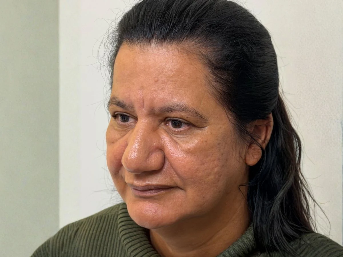 Antes Protocolo Elleve